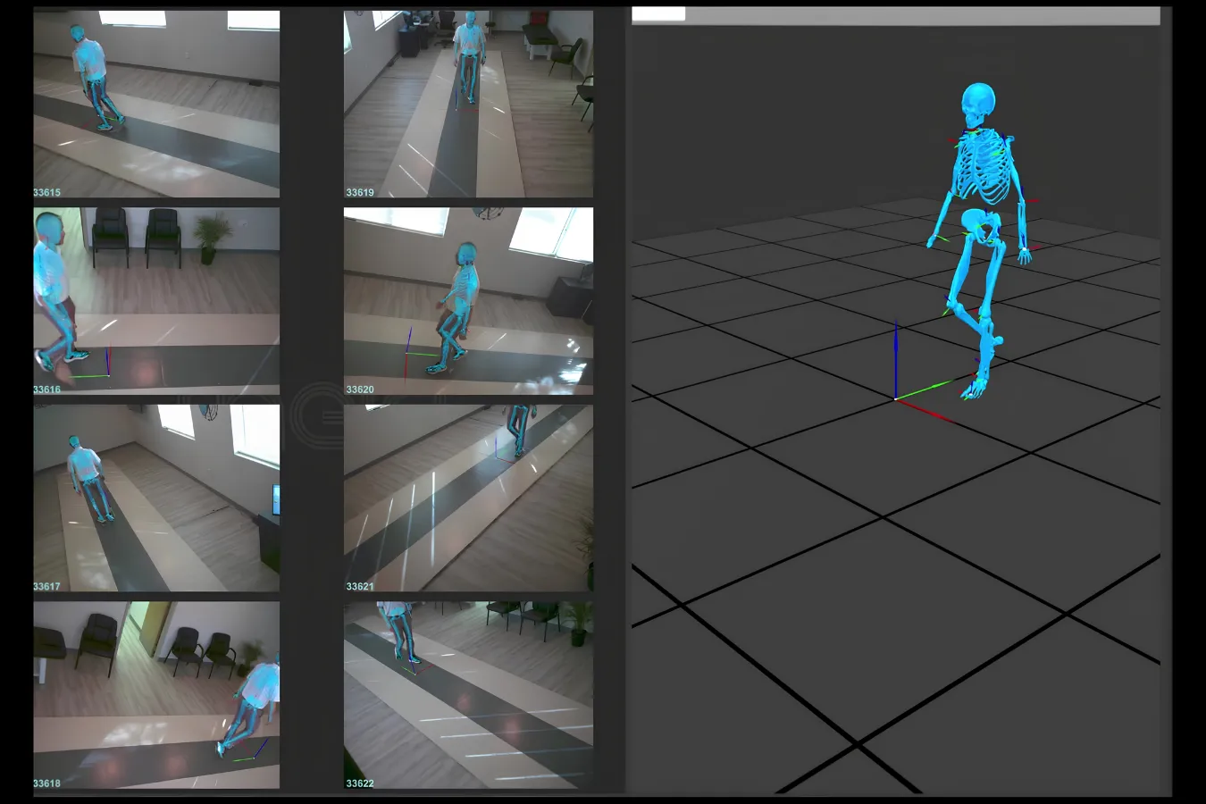 Motion capture gait analysis showing a patient's walking mechanics